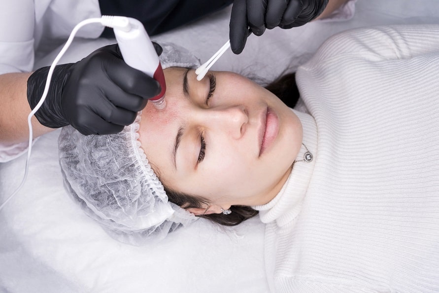 how to care for your skin after microneedling